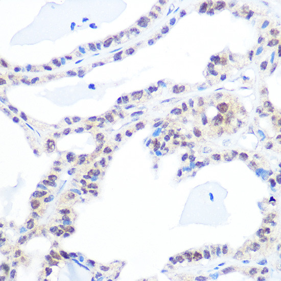 TOP1 Antibody in Immunohistochemistry (Paraffin) (IHC (P))