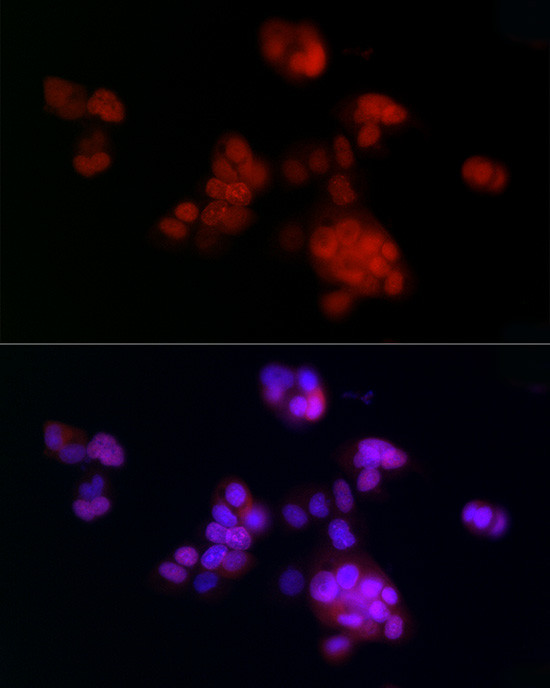 PCNA Antibody in Immunocytochemistry (ICC/IF)