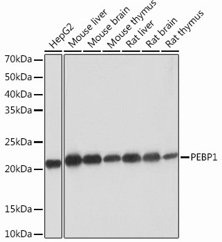 PEBP1 Antibody in Western Blot (WB)