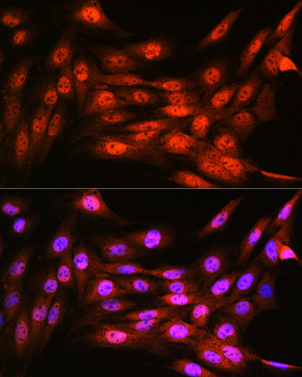 VCP Antibody in Immunocytochemistry (ICC/IF)