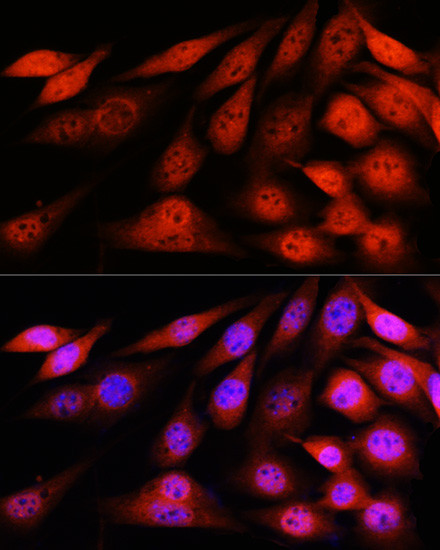 VCP Antibody in Immunocytochemistry (ICC/IF)