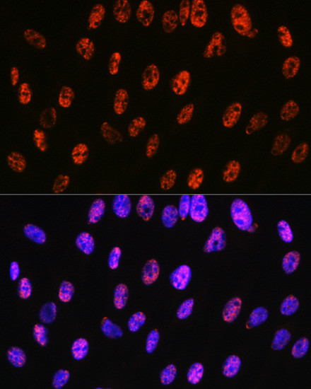 PABPN1 Antibody in Immunocytochemistry (ICC/IF)