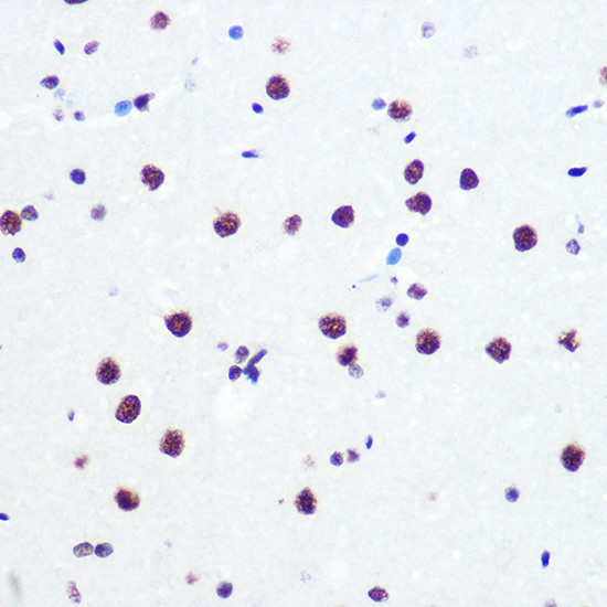 PABPN1 Antibody in Immunohistochemistry (Paraffin) (IHC (P))