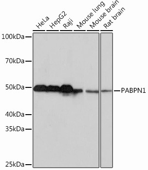 PABPN1 Antibody in Western Blot (WB)