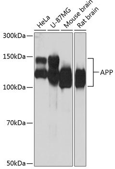 Amyloid Precursor Protein Antibody in Western Blot (WB)