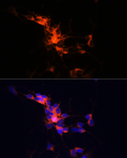 beta-3 Tubulin Antibody in Immunocytochemistry (ICC/IF)