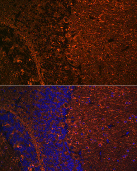 beta-3 Tubulin Antibody in Immunohistochemistry (Paraffin) (IHC (P))