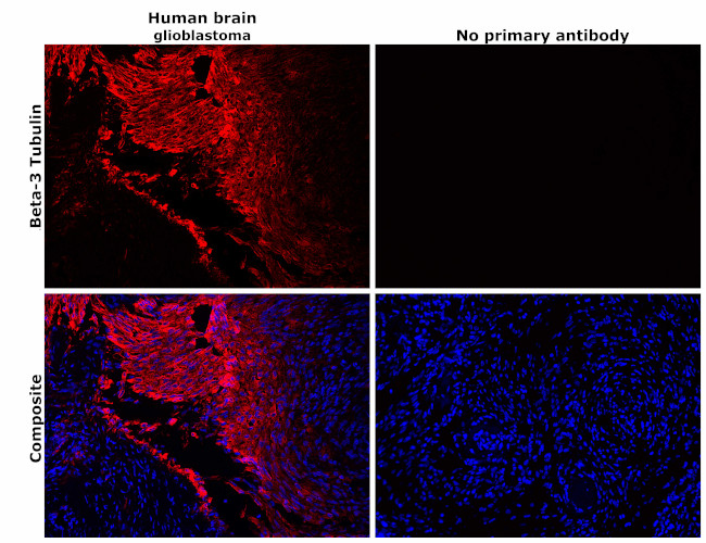 beta-3 Tubulin Antibody in Immunohistochemistry (Paraffin) (IHC (P))