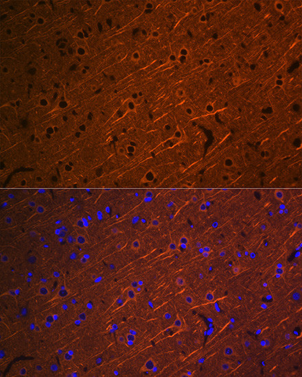 beta-3 Tubulin Antibody in Immunohistochemistry (Paraffin) (IHC (P))