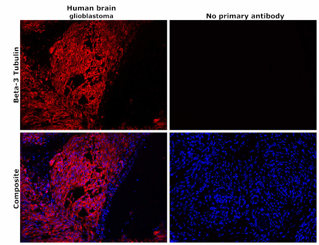 beta-3 Tubulin Antibody in Immunohistochemistry (Paraffin) (IHC (P))