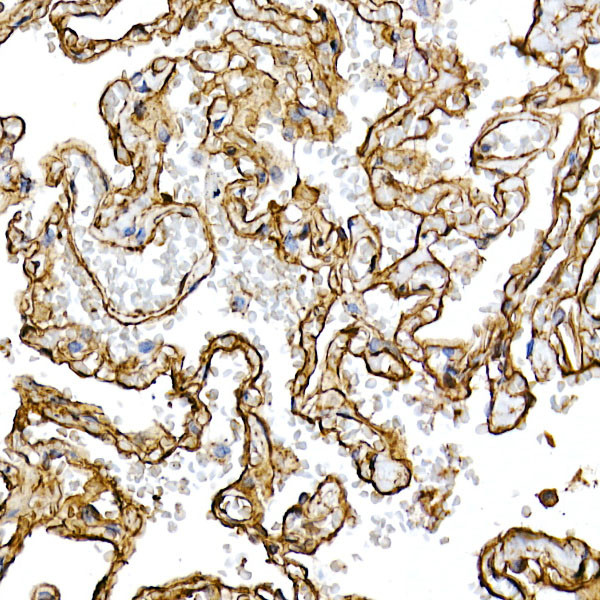 Caveolin 1 Antibody in Immunohistochemistry (Paraffin) (IHC (P))