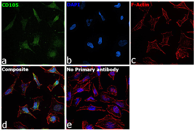 CD105 Antibody in Immunocytochemistry (ICC/IF)