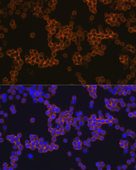 CD14 Antibody in Immunocytochemistry (ICC/IF)