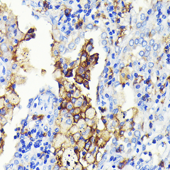 CD14 Antibody in Immunohistochemistry (Paraffin) (IHC (P))