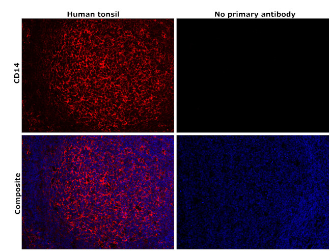 CD14 Antibody in Immunohistochemistry (Paraffin) (IHC (P))