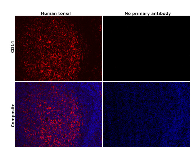 CD14 Antibody in Immunohistochemistry (Paraffin) (IHC (P))