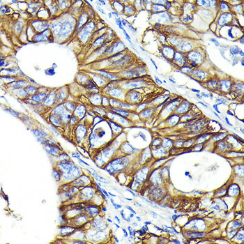 CD46 Antibody in Immunohistochemistry (Paraffin) (IHC (P))