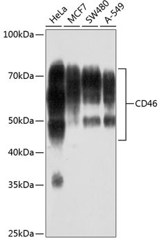 CD46 Antibody in Western Blot (WB)