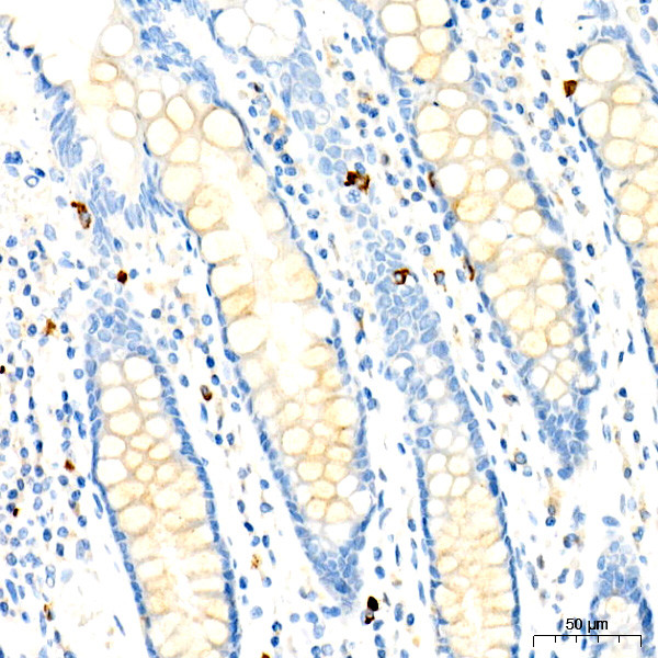 CD63 Antibody in Immunohistochemistry (Paraffin) (IHC (P))