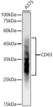 CD63 Antibody in Western Blot (WB)