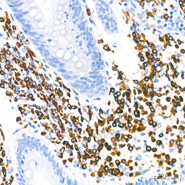 CD79a Antibody in Immunohistochemistry (Paraffin) (IHC (P))