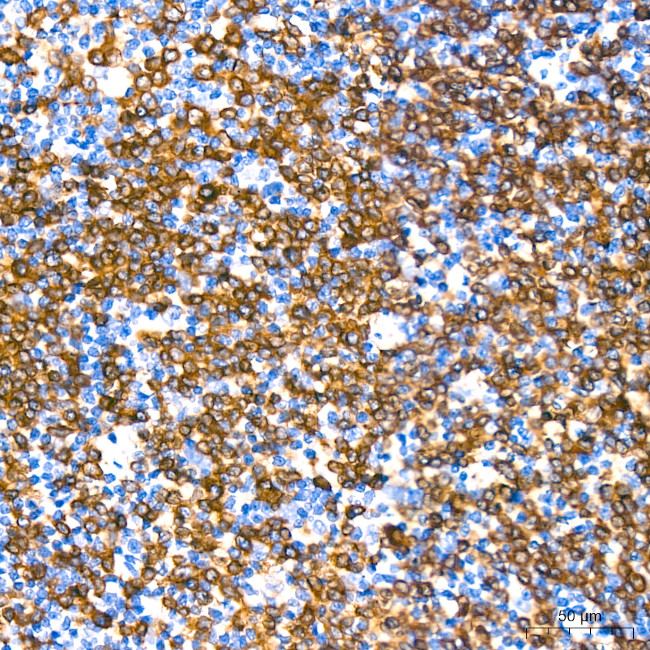 CD79a Antibody in Immunohistochemistry (Paraffin) (IHC (P))