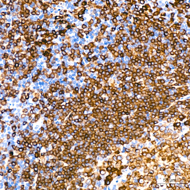 CD79a Antibody in Immunohistochemistry (Paraffin) (IHC (P))