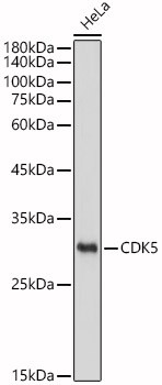 CDK5 Antibody in Western Blot (WB)