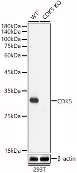 CDK5 Antibody in Western Blot (WB)