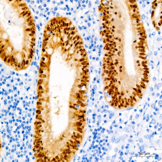 CDX2 Antibody in Immunohistochemistry (Paraffin) (IHC (P))