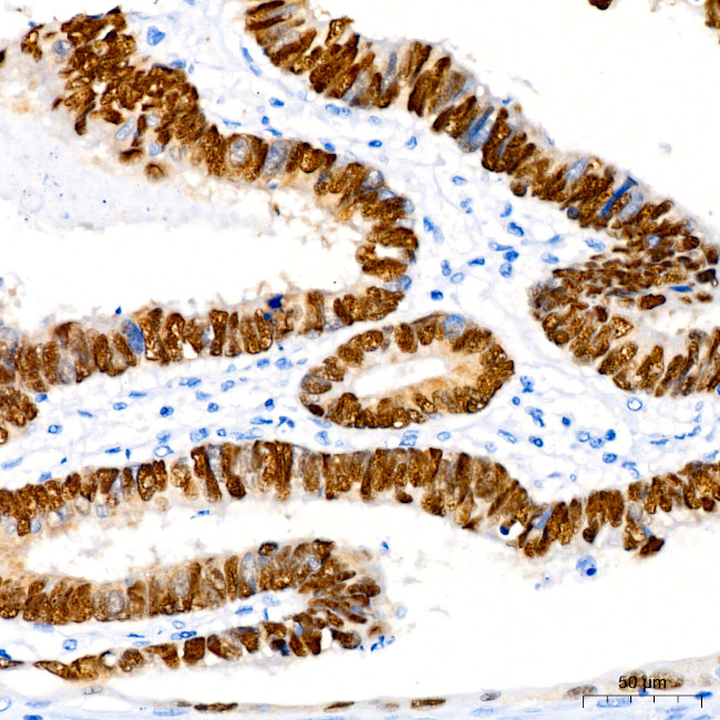 CDX2 Antibody in Immunohistochemistry (Paraffin) (IHC (P))