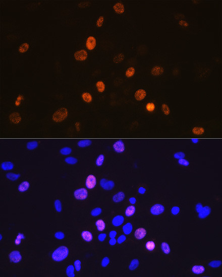 Cyclin A2 Antibody in Immunocytochemistry (ICC/IF)