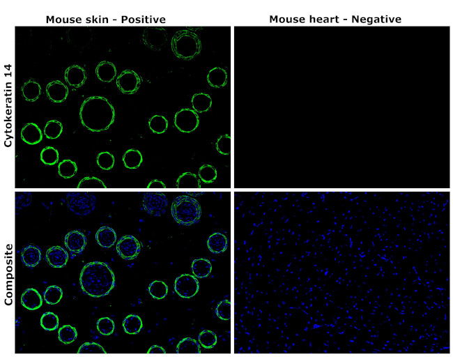 Cytokeratin 14 Antibody in Immunohistochemistry (Paraffin) (IHC (P))