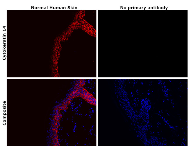 Cytokeratin 14 Antibody in Immunohistochemistry (Paraffin) (IHC (P))