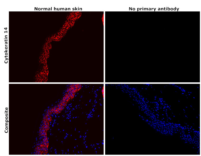 Cytokeratin 14 Antibody in Immunohistochemistry (Paraffin) (IHC (P))