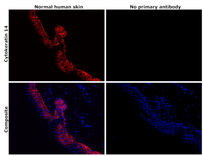 Cytokeratin 14 Antibody in Immunohistochemistry (Paraffin) (IHC (P))