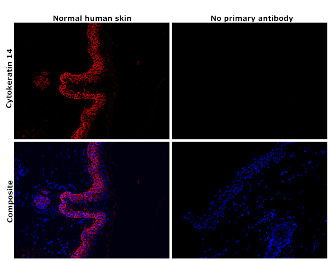 Cytokeratin 14 Antibody in Immunohistochemistry (Paraffin) (IHC (P))