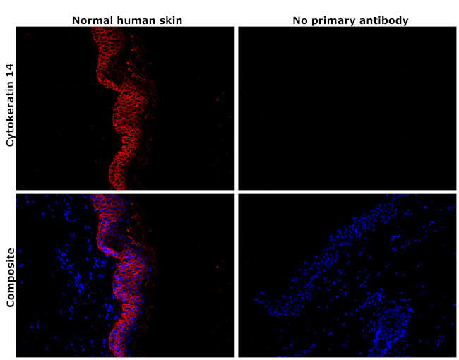 Cytokeratin 14 Antibody in Immunohistochemistry (Paraffin) (IHC (P))