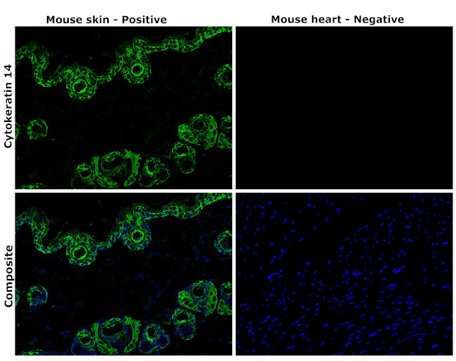 Cytokeratin 14 Antibody in Immunohistochemistry (Paraffin) (IHC (P))