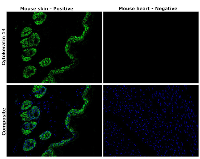 Cytokeratin 14 Antibody in Immunohistochemistry (Paraffin) (IHC (P))