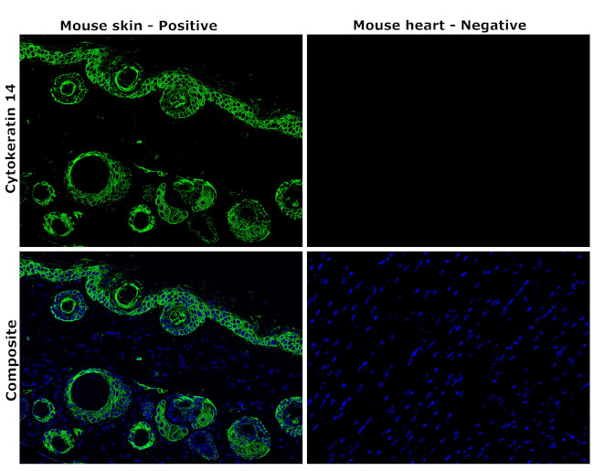 Cytokeratin 14 Antibody in Immunohistochemistry (Paraffin) (IHC (P))