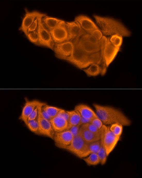 Cytokeratin 19 Antibody in Immunocytochemistry (ICC/IF)