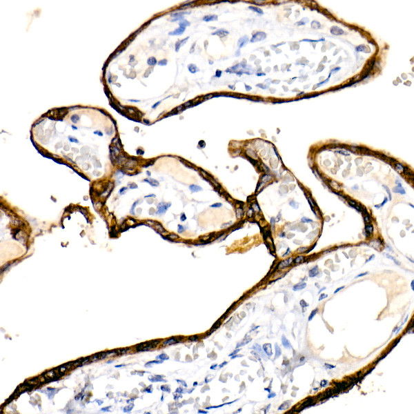 Cytokeratin 19 Antibody in Immunohistochemistry (Paraffin) (IHC (P))