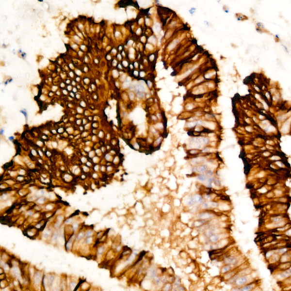 Cytokeratin 20 Antibody in Immunohistochemistry (Paraffin) (IHC (P))