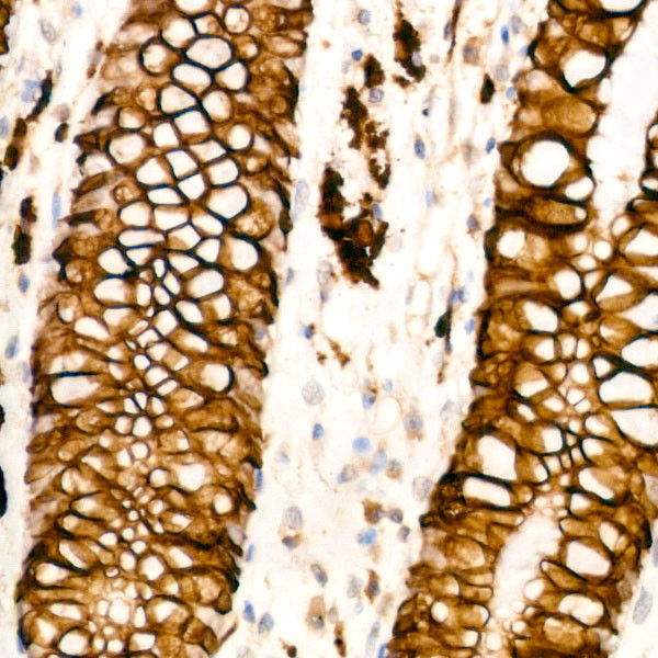 Cytokeratin 20 Antibody in Immunohistochemistry (Paraffin) (IHC (P))