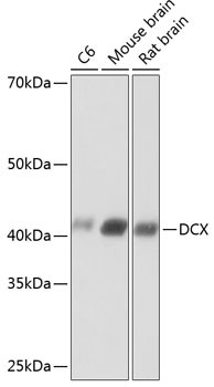 Doublecortin Antibody in Western Blot (WB)