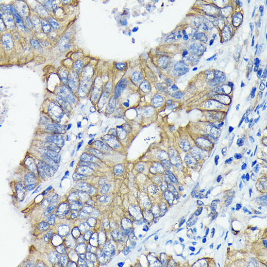 TRAIL-R2 (DR5) Antibody in Immunohistochemistry (Paraffin) (IHC (P))