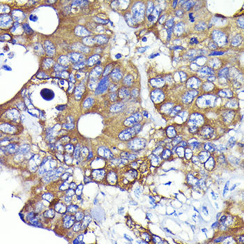 Ezrin Antibody in Immunohistochemistry (Paraffin) (IHC (P))