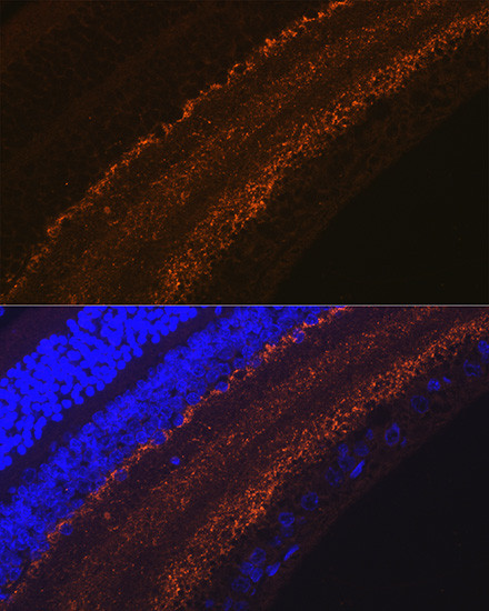 GAP43 Antibody in Immunohistochemistry (Paraffin) (IHC (P))