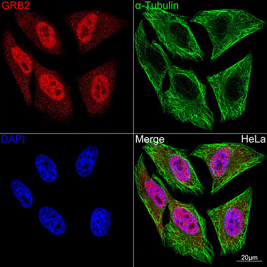 GRB2 Antibody in Immunocytochemistry (ICC/IF)